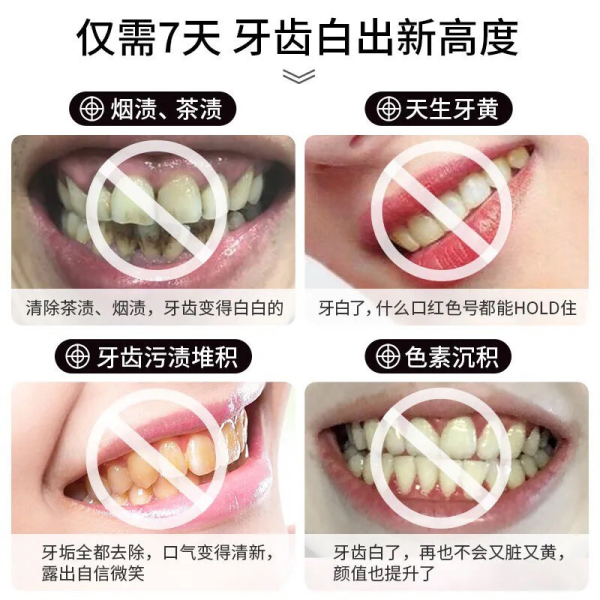 maputi 牙齒美白精華漱口水牙貼7支/盒1盒：圖片 4